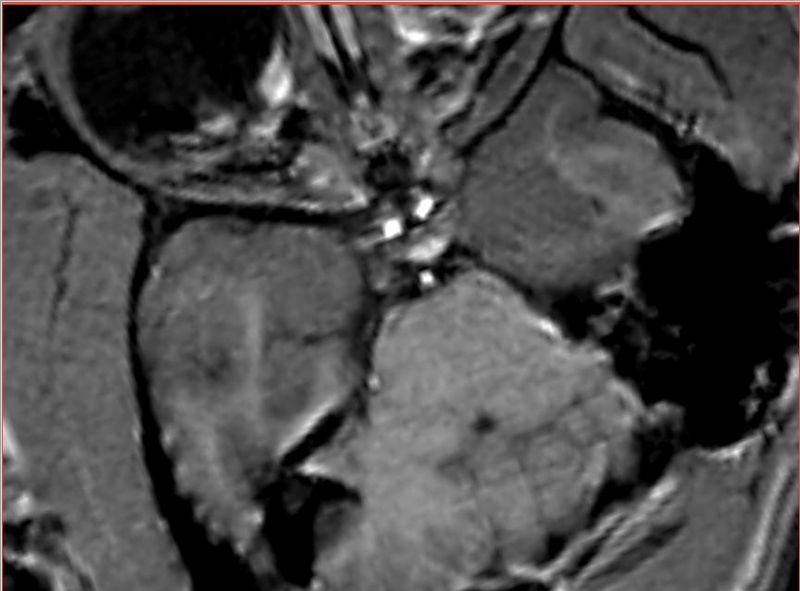 File:Calvin-susceptibility.jpg
