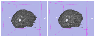 Itk fixed volume 006.png