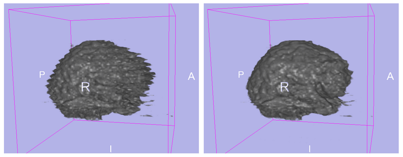 File:Itk fixed volume 006.png