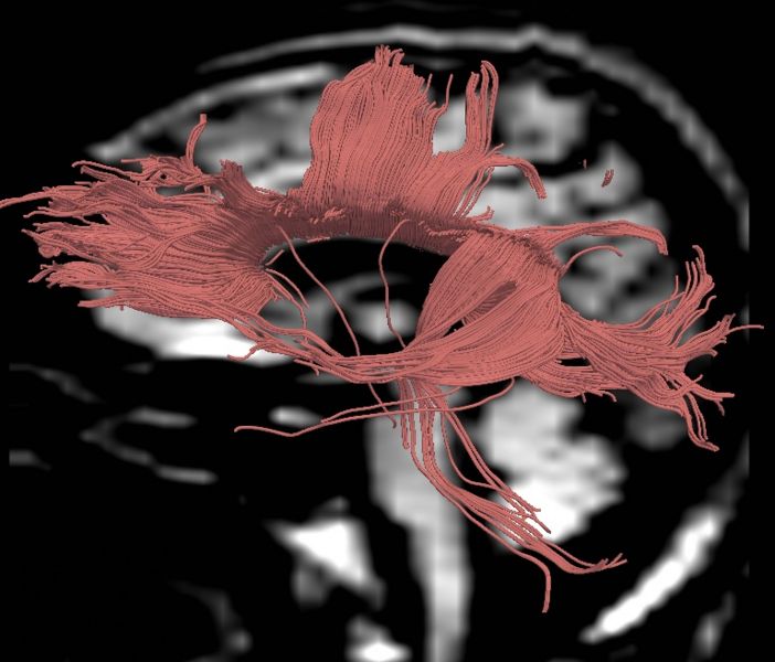 File:CaseD00724 L blur10.jpg