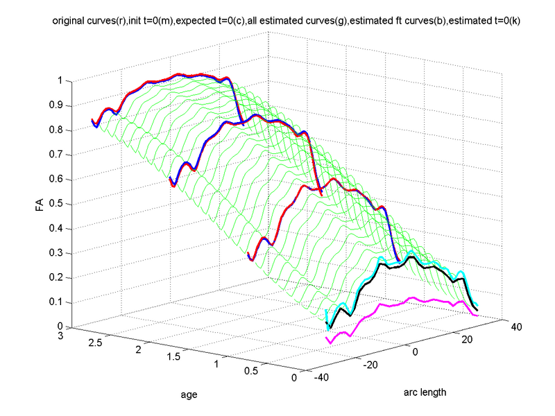 File:Namic tract longitudinal.png