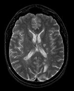 this is a passive image to which the calculated transform is applied. It is a label-map in the same space as the moving FLAIR image