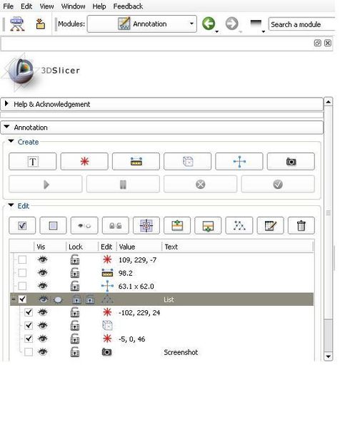 File:Slicer4-AnnotationGUI.jpg