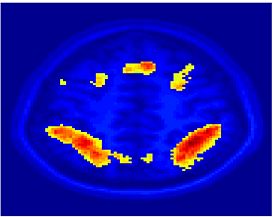 Mit fmri clustering SC 5Clust 1.jpeg