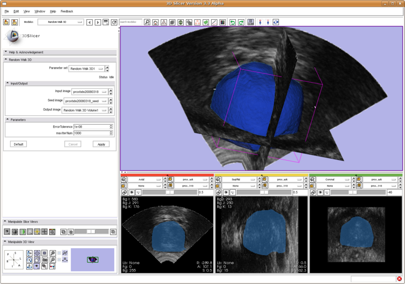 File:SlicerRandomWalkProstate.png
