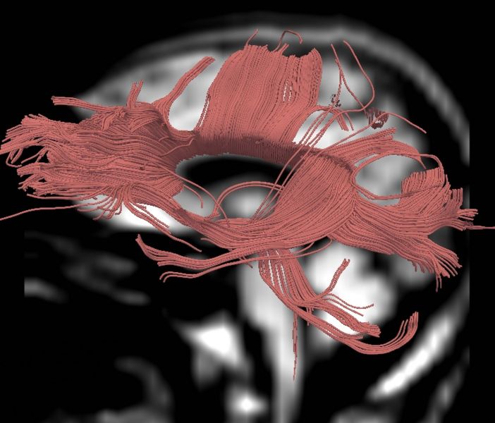 File:CaseD00724 L blur25.jpg