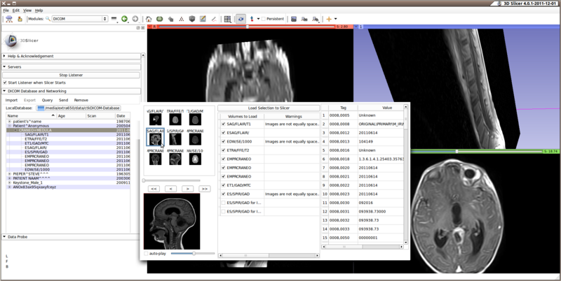 File:Slicer4-DICOM-2011-12-05.png