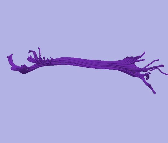 File:CaseD0608 L dil3 sens60.jpg