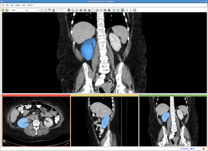 File:RSS rkidney.png