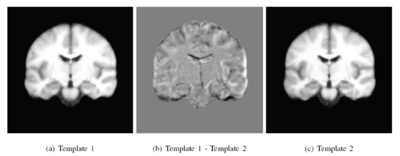 Two templates in a 50 subject MRI.