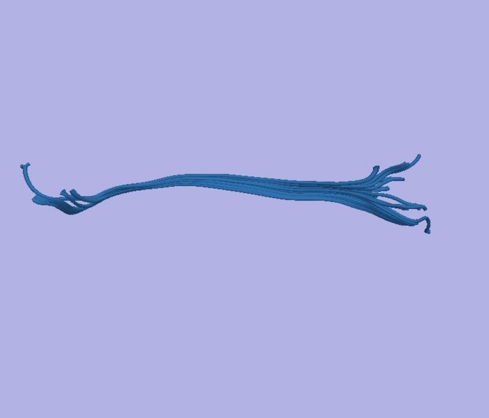 File:CaseD0608 L dil0 sens100.jpg