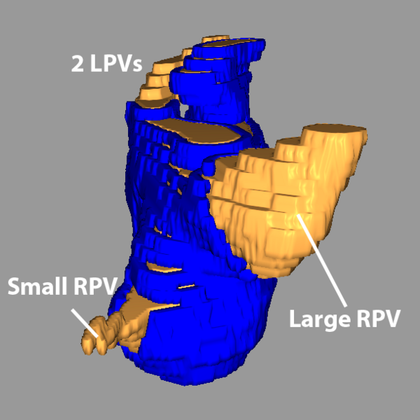 File:Carma RPVs small.png