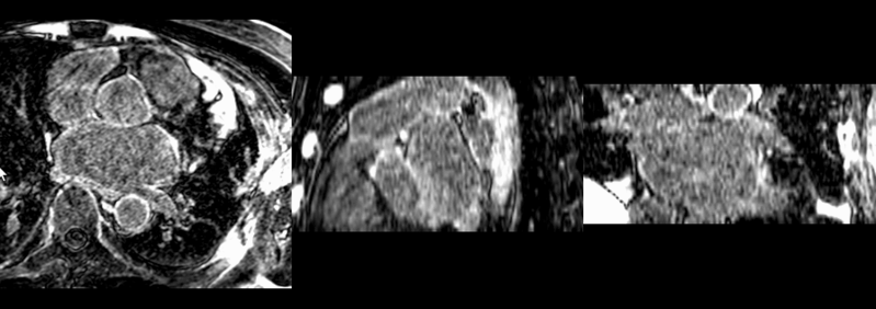 File:Post to pre demons.gif