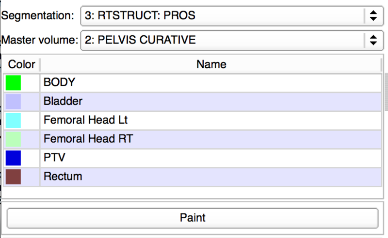 File:20160108 SegmentEditor.png