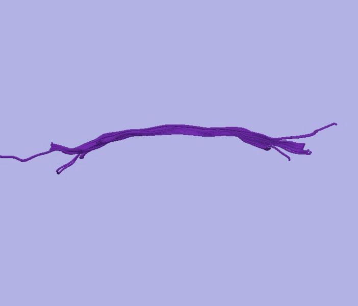 File:CaseD0688 L dil3 sens100.jpg