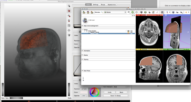 File:Slicer-MeVisLab 2012-09-26.png