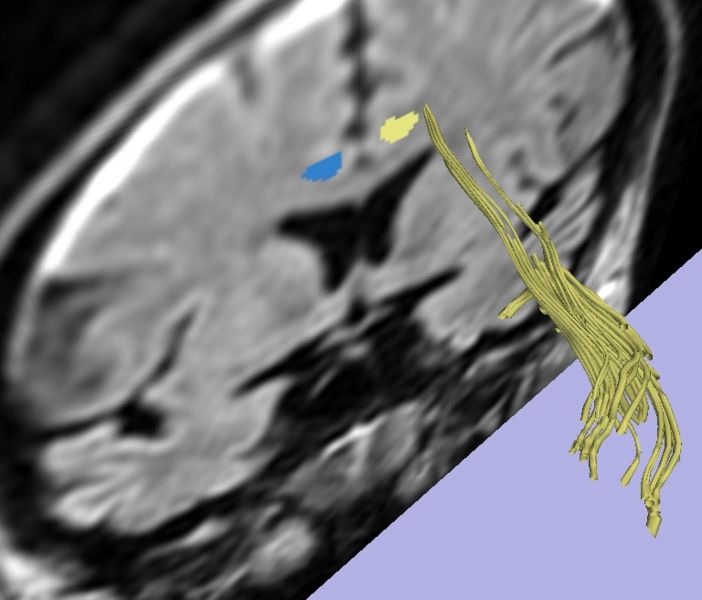 File:Missed 2nd ROI.jpg