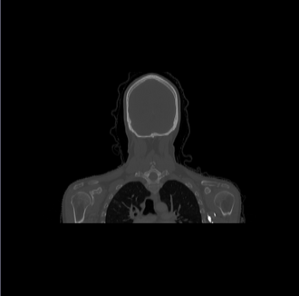 Coronal orig image.png