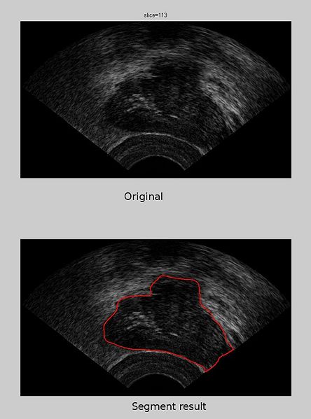 File:SgmResult ghe100 withOriginal 113.jpg