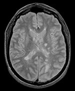 this is the moving image. The transform is calculated by matching this to the reference image