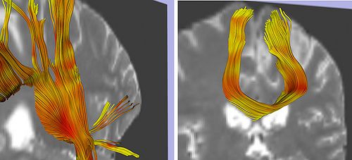 LMI PNL BWH LWMGFDTG.jpg