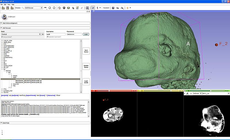 File:XNATSlicerScreenshot3 6-12.JPG