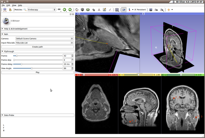 File:3D Slicer 4.0.1.2012-01-07 175.png