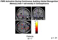 NAMIC AVrecog prelim results.jpg