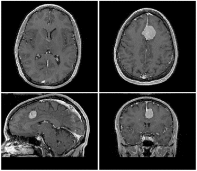 original orientation