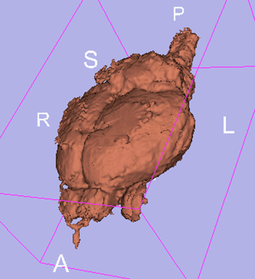 Surface model of original unregistered brains
