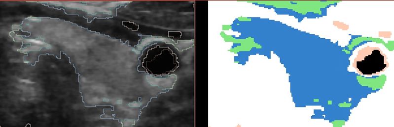 File:US EMSeg WithAtlas.jpg