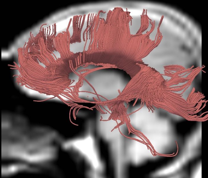 File:CaseD0711 L smoothed2x.jpg