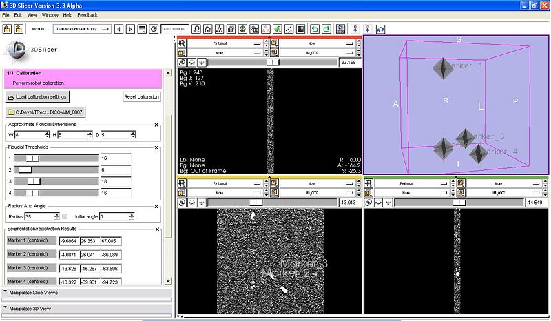 File:TRProstateBiopsy Calibration.JPG