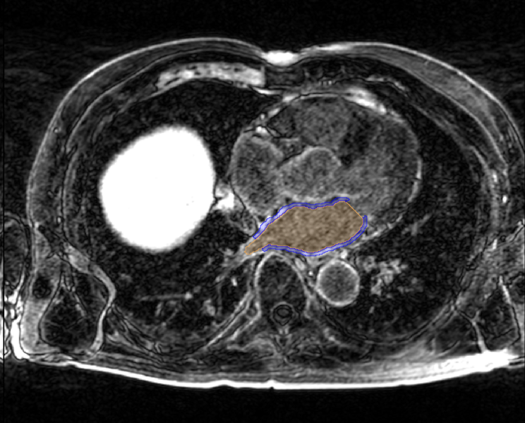 File:Carma ex post seg.png