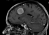 RegLib C01: Tumor change assessment