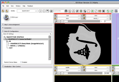 TryVersion2 SlicerShowImage.png