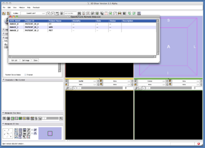 TryVersion2 SlicerGetRemoteDataList.png