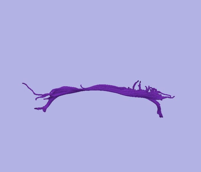 File:CaseD00724 L dil9 sens80.jpg