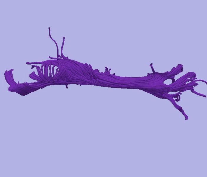 File:CaseD0608 L dil7 sens20.jpg