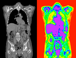 this is the fixed PET/CT image. All images are aligned into this space