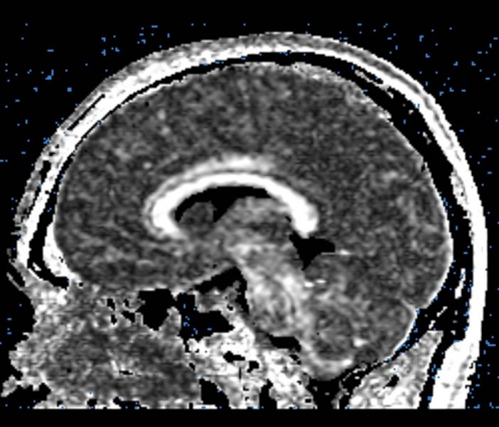 File:CaseD100 B3.jpg