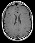 this is a passive image to which the calculated transform is applied. It is a label-map in the same space as the moving FLAIR image