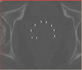 Thumbnail for version as of 22:59, 15 June 2010