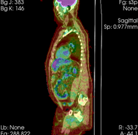 this is the moving image. The transform is calculated by matching this to the reference image