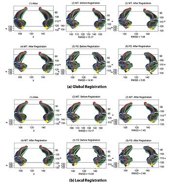 Shen-Hippocampus2009-fig5.jpg