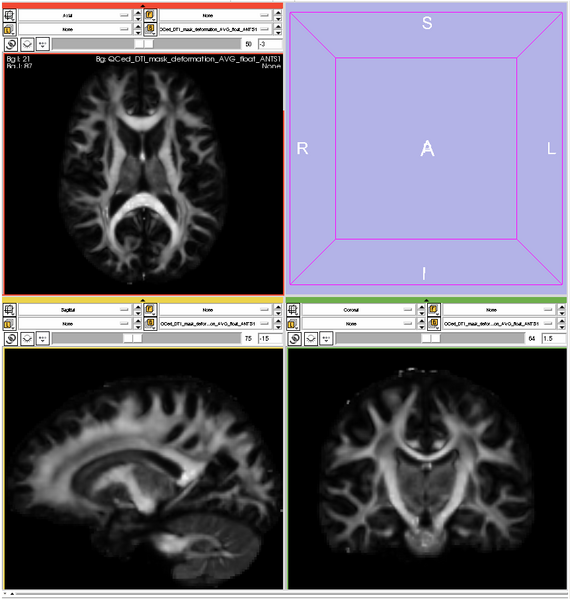 File:High resolution DTI atlas.png