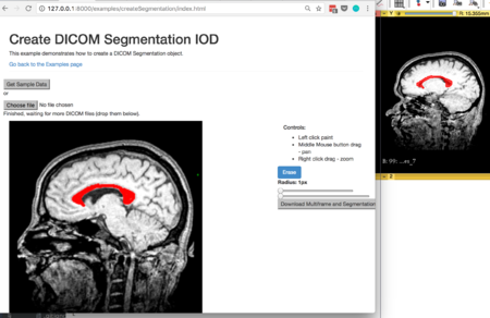Project Week 25/DICOM Segmentation Support for Cornerstone and OHIF ...