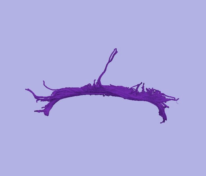 File:CaseD00724 L dil5 sens20.jpg