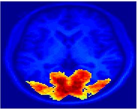 Mit fmri clustering SC 5Clust 3.jpeg