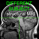 Registration HLogo InterMRI.png